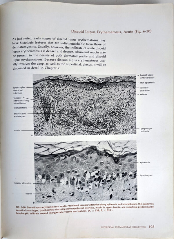 Histologic Diagnosis of Inflammatory Skin Diseases - Image 4