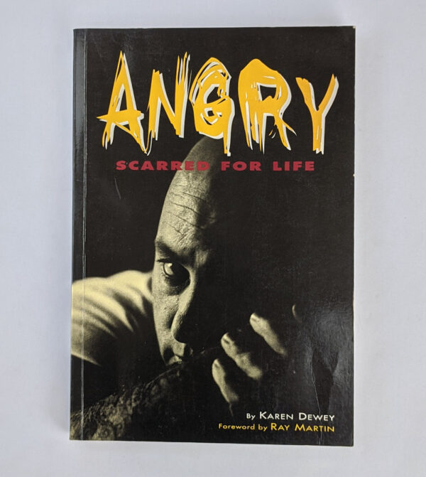 Angry: Scarred For Life