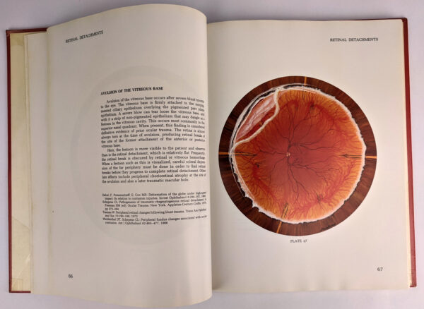 Atlas of the Peripheral Retina - Image 2