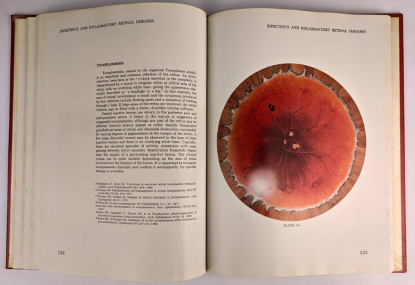 Atlas of the Peripheral Retina - Image 3