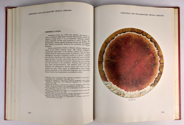 Atlas of the Peripheral Retina - Image 4