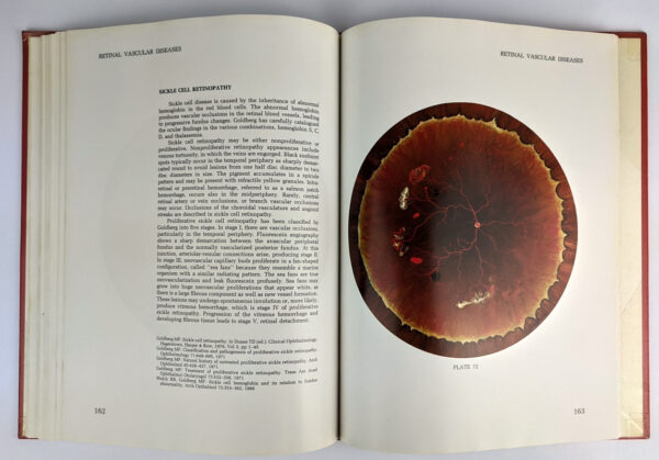 Atlas of the Peripheral Retina - Image 5
