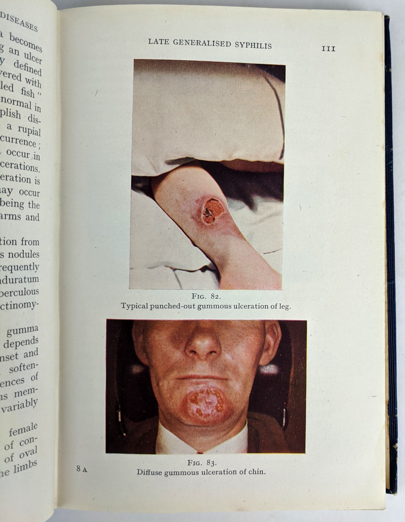 Handbook of diagnosis treatment of venereal diseases the book