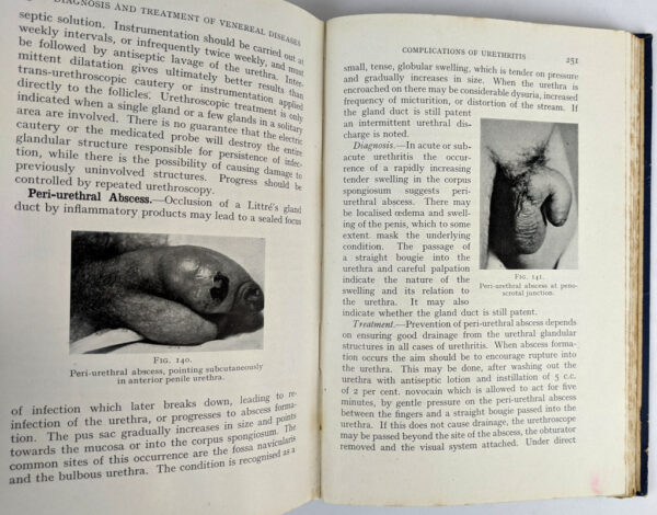 Handbook of Diagnosis & Treatment of Venereal Diseases - Image 3