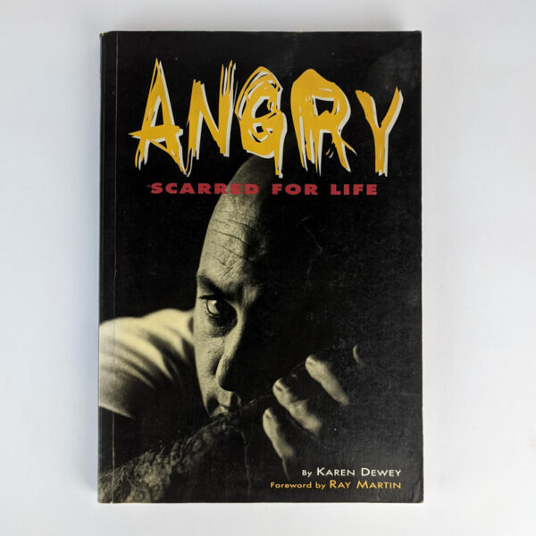 Angry: Scarred For Life