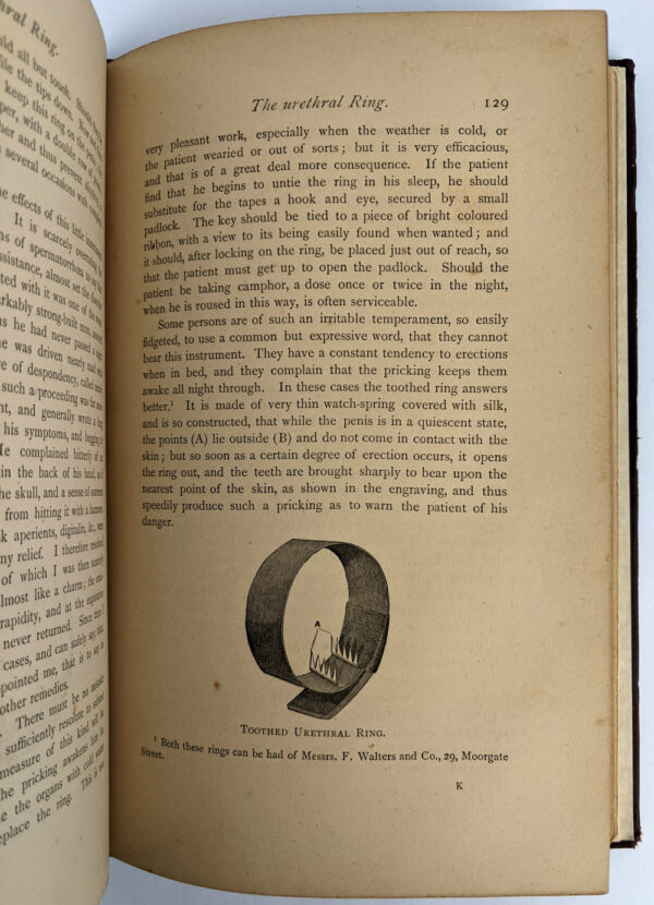 On the Pathology and Treatment of Spermatorrhoea - Image 8