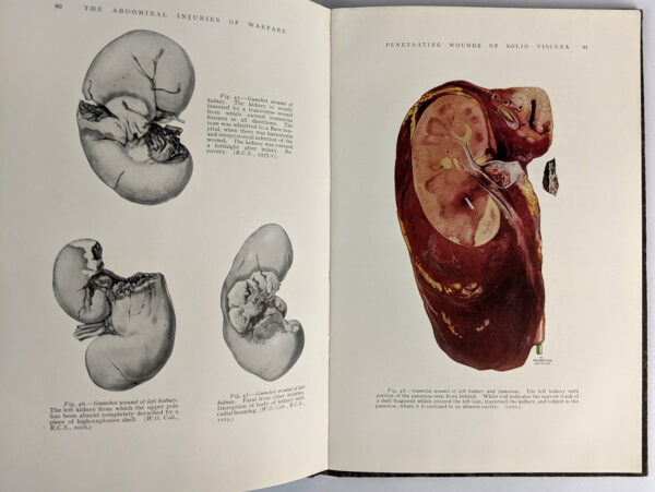 The Abdominal Injuries of Warfare - Image 2