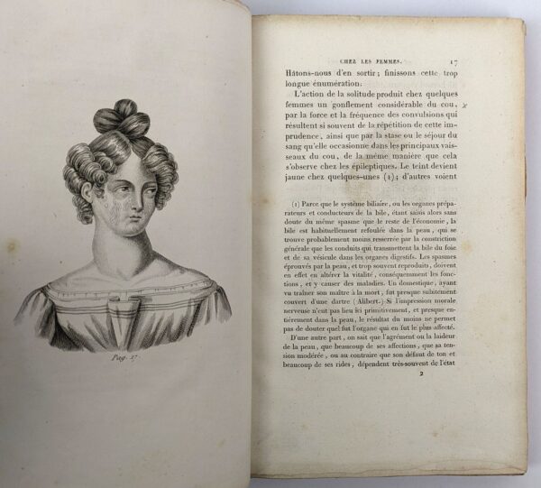 Des Habitudes Secretes ou des Maladies Produites par l'Onanisme chez les Femmes - Image 4