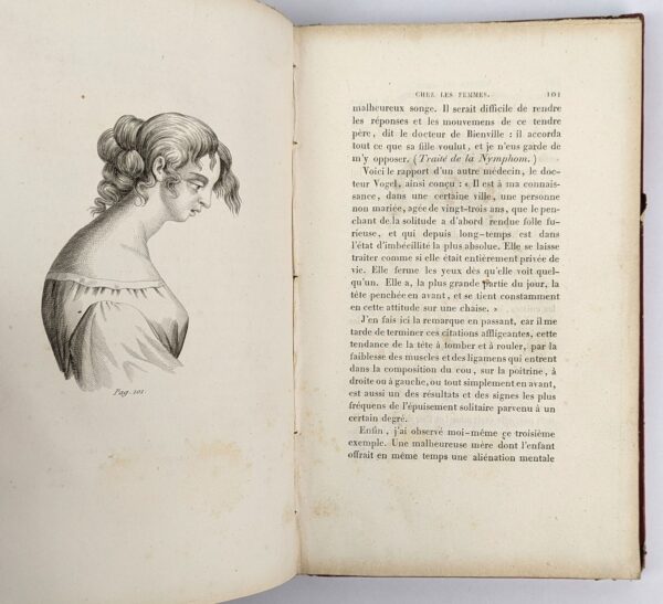 Des Habitudes Secretes ou des Maladies Produites par l'Onanisme chez les Femmes - Image 6