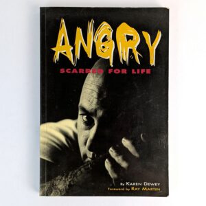 Angry: Scarred For Life