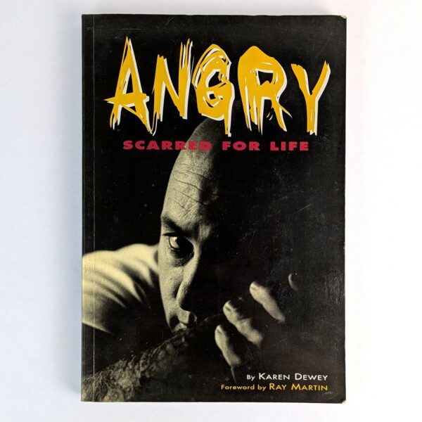 Angry: Scarred For Life