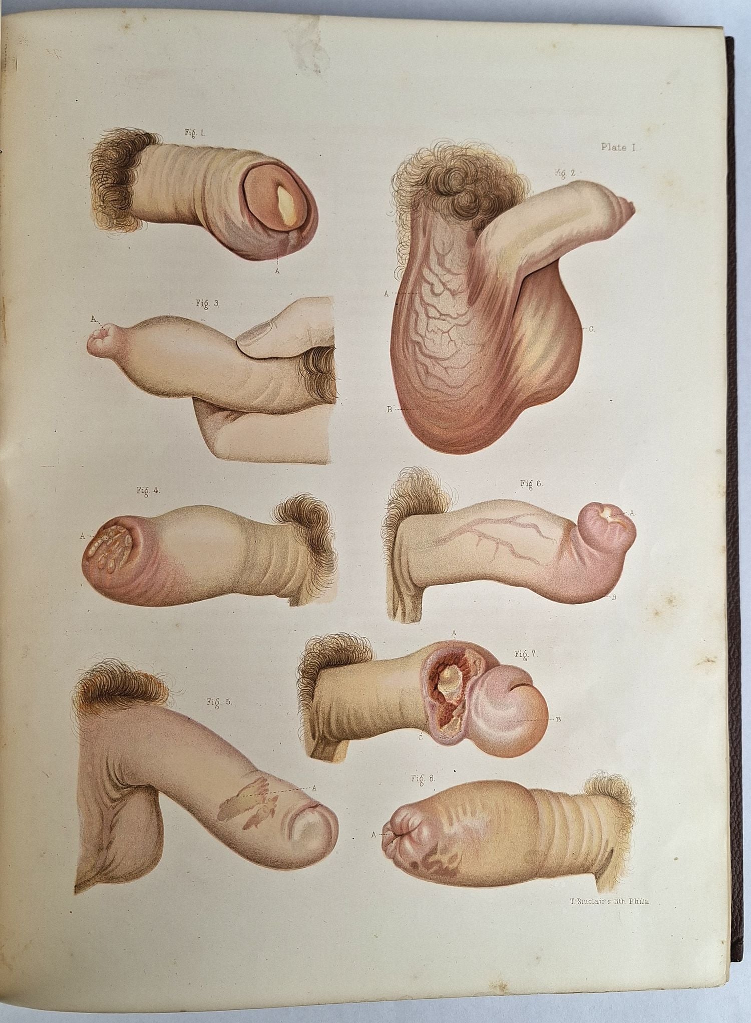 Atlas of Venereal Diseases - Image 3