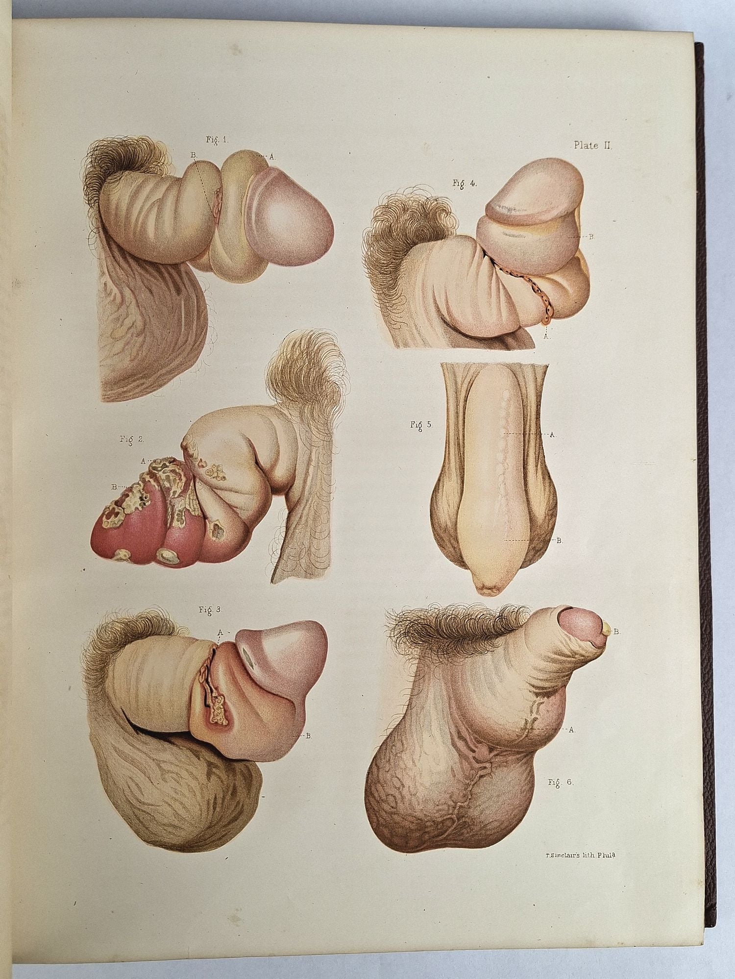 Atlas of Venereal Diseases - Image 4