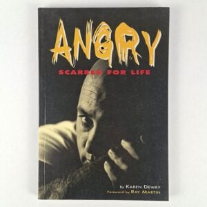 Angry: Scarred For Life